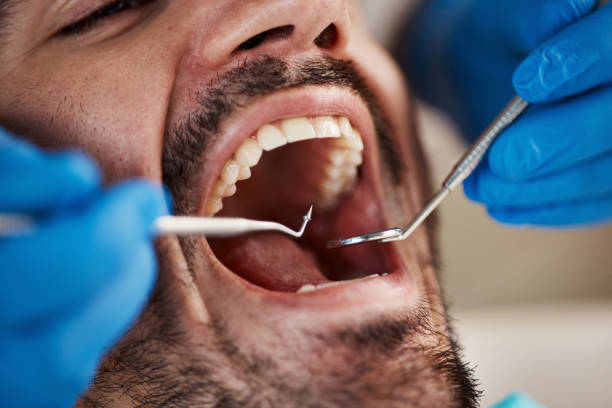 Best Emergency Dental Care for Broken or Chipped Teeth in Klamath Falls, OR